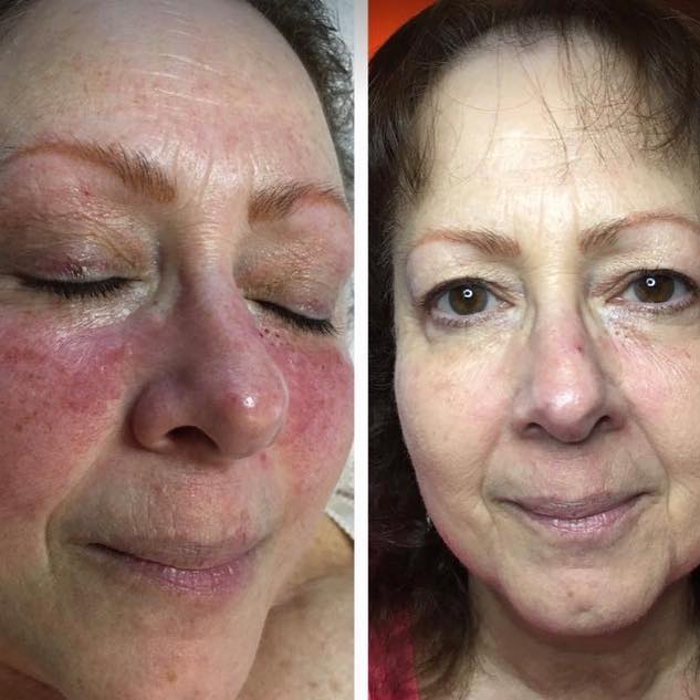 Body Sugaring